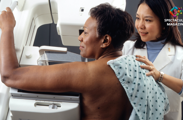 Starting Mammography at Age 40 Would Reduce Disparities in Deaths for Black Women